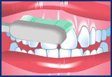 Changez votre faon habituelle de vous brosser les dents. La plupart des gens brossent toujours leurs dents de la mme faon. Cela signifie qu'ils manquent toujours les mmes endroits. Essayez de modifier votre routine habituelle.